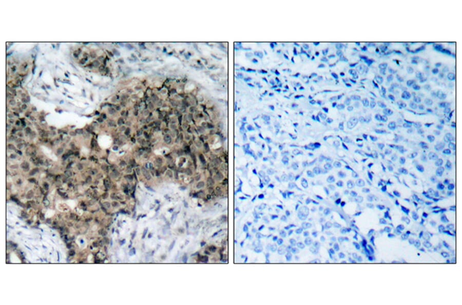 Immunohistochemistry - Anti-ATM Antibody (B7018) - Antibodies.com