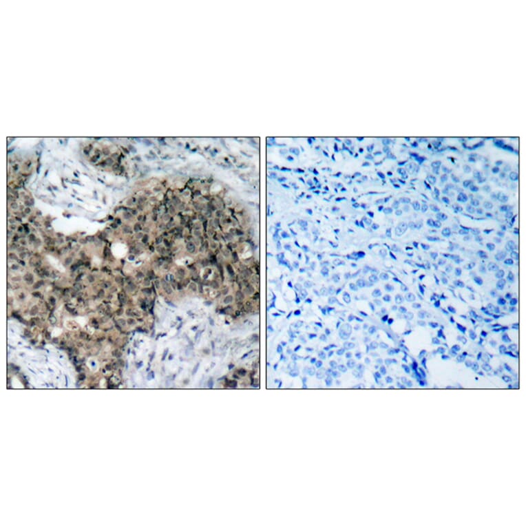 Immunohistochemistry - Anti-ATM Antibody (B7018) - Antibodies.com