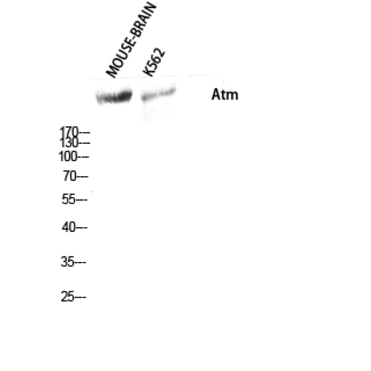 Western Blot - Anti-ATM Antibody (B7018) - Antibodies.com