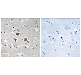 Immunohistochemistry - Anti-ALK Antibody (B8077) - Antibodies.com