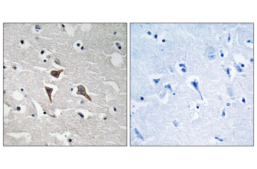 Immunohistochemistry - Anti-ALK Antibody (B8077) - Antibodies.com