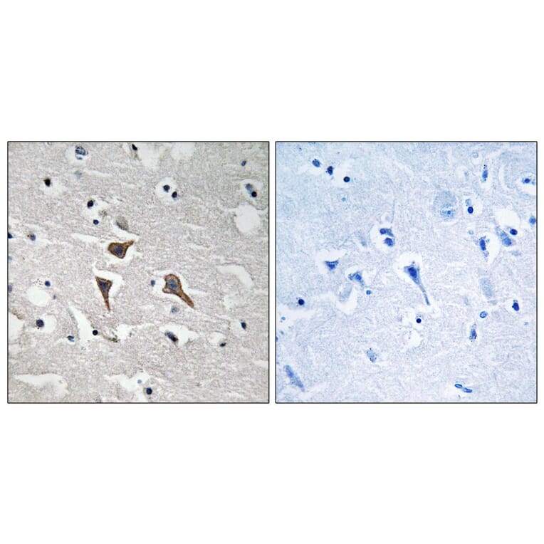 Immunohistochemistry - Anti-ALK Antibody (B8077) - Antibodies.com