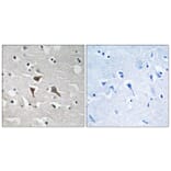 Immunohistochemistry - Anti-ALK Antibody (B8077) - Antibodies.com