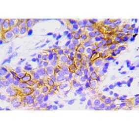 Immunohistochemistry - Anti-ALK Antibody (R12-2018) - Antibodies.com