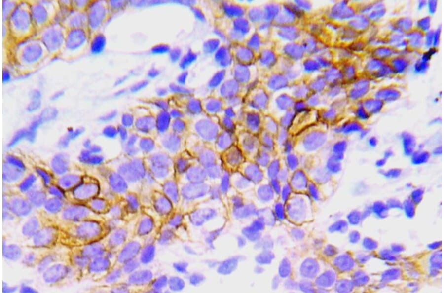 Immunohistochemistry - Anti-ALK Antibody (R12-2018) - Antibodies.com