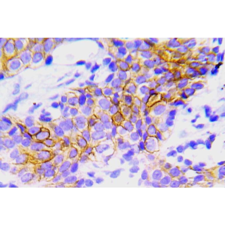 Immunohistochemistry - Anti-ALK Antibody (R12-2018) - Antibodies.com