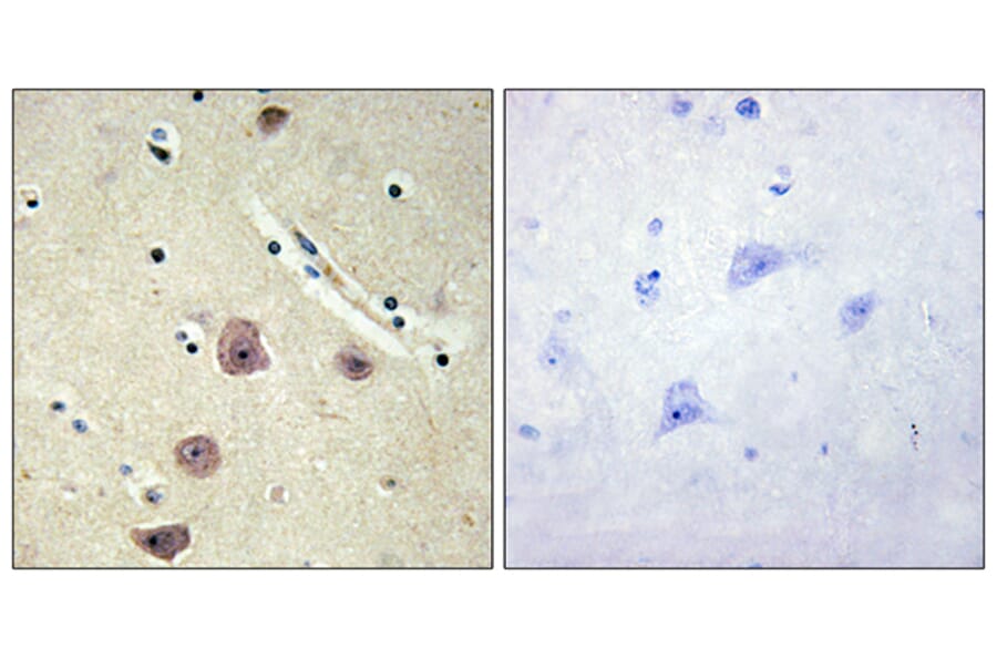 Immunohistochemistry - Anti-AK5 Antibody (C11988) - Antibodies.com