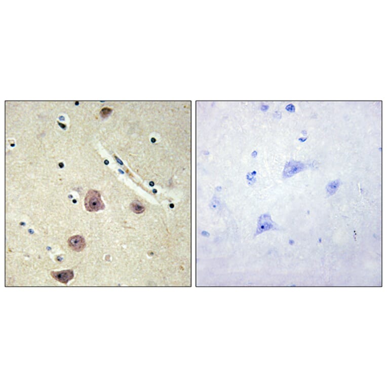 Immunohistochemistry - Anti-AK5 Antibody (C11988) - Antibodies.com