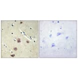 Immunohistochemistry - Anti-AK5 Antibody (C11988) - Antibodies.com