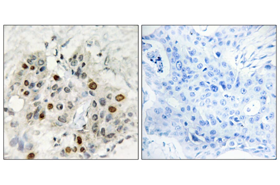 Immunohistochemistry - Anti-AF4 Antibody (C10690) - Antibodies.com