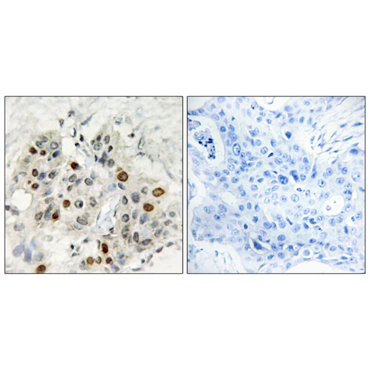 Immunohistochemistry - Anti-AF4 Antibody (C10690) - Antibodies.com