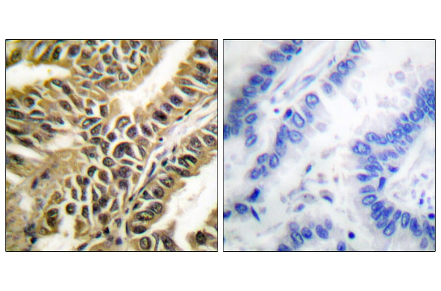 Immunohistochemistry - Anti-Abl Antibody (B0403) - Antibodies.com