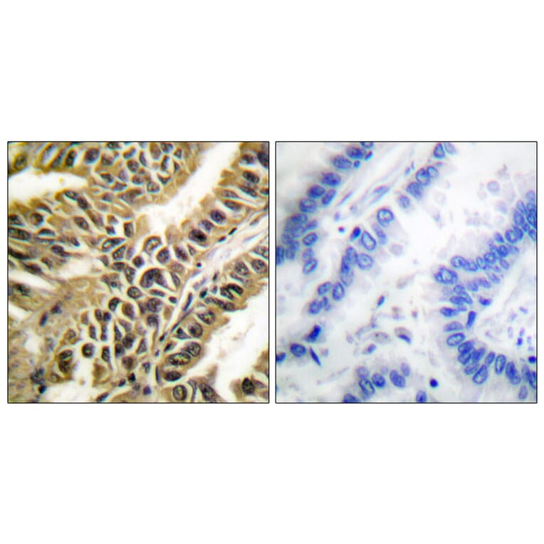 Immunohistochemistry - Anti-Abl Antibody (B0403) - Antibodies.com