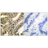 Immunohistochemistry - Anti-Abl Antibody (B0403) - Antibodies.com