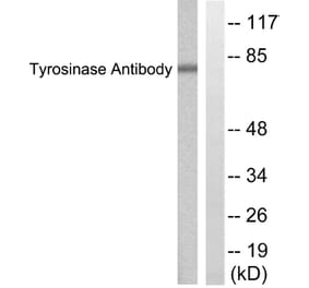 Western Blot - Anti-Tyrosinase Antibody (C0382) - Antibodies.com