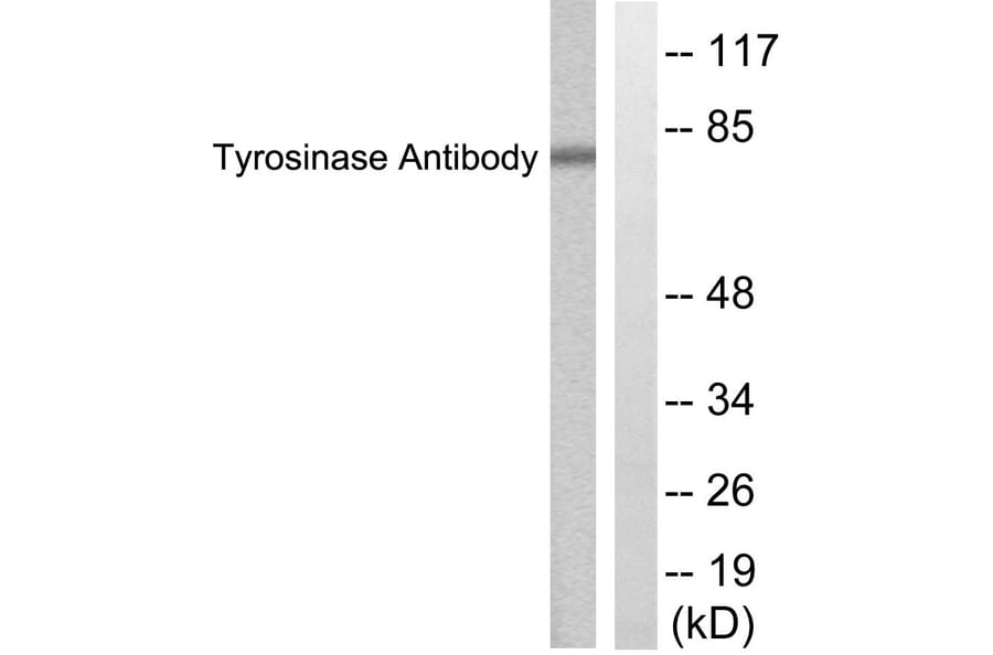 Western Blot - Anti-Tyrosinase Antibody (C0382) - Antibodies.com