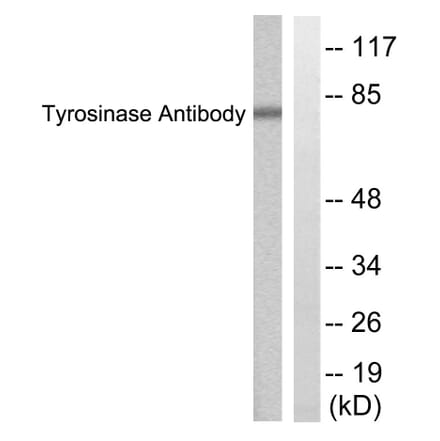 Western Blot - Anti-Tyrosinase Antibody (C0382) - Antibodies.com