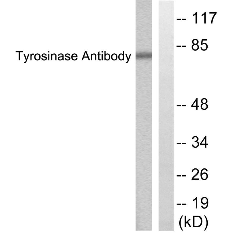 Western Blot - Anti-Tyrosinase Antibody (C0382) - Antibodies.com