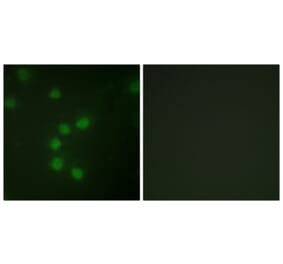 Immunofluorescence - Anti-Telomerase Antibody (B1182) - Antibodies.com