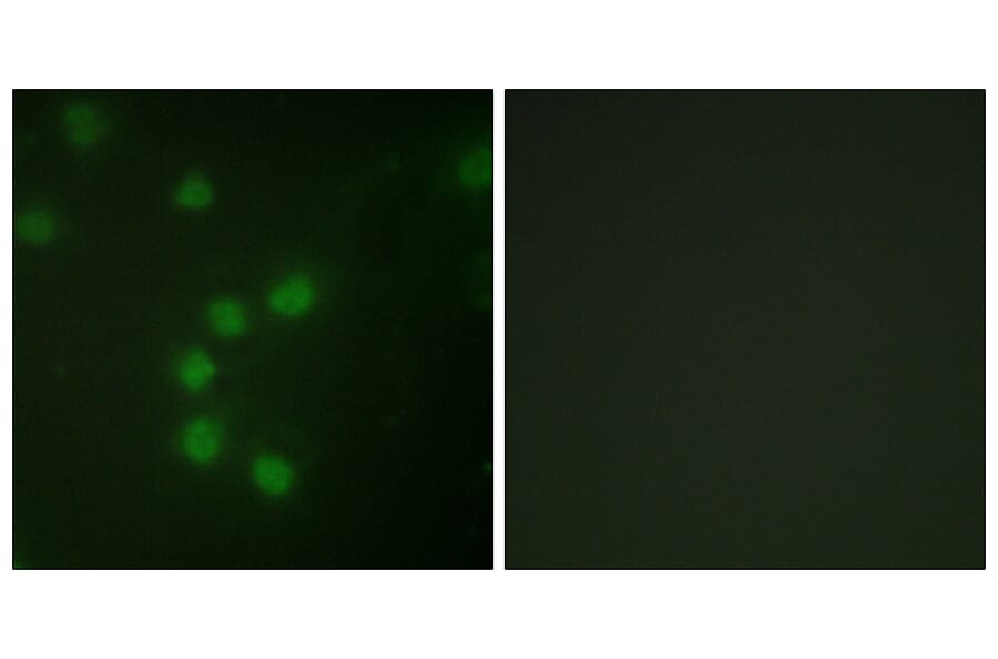 Immunofluorescence - Anti-Telomerase Antibody (B1182) - Antibodies.com