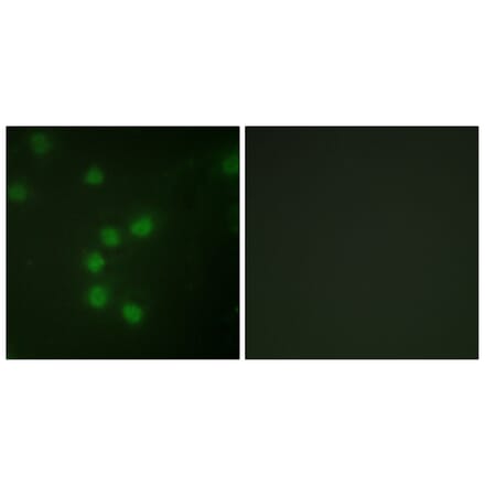 Immunofluorescence - Anti-Telomerase Antibody (B1182) - Antibodies.com