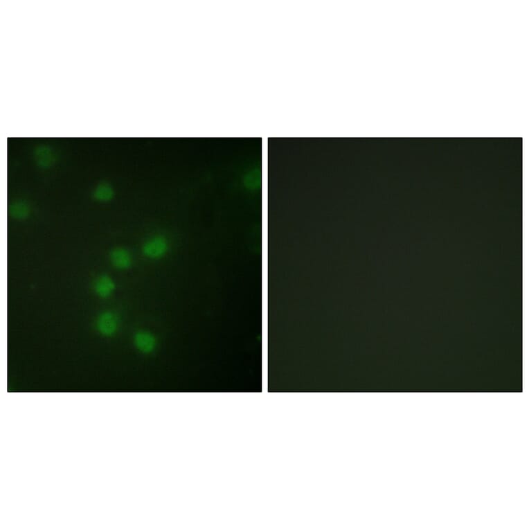 Immunofluorescence - Anti-Telomerase Antibody (B1182) - Antibodies.com