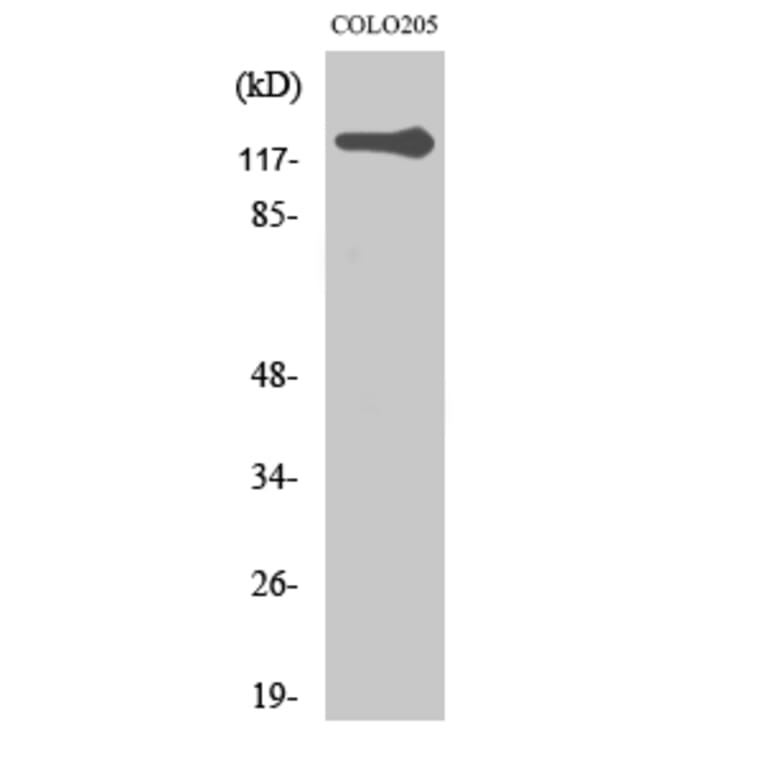 Western Blot - Anti-Telomerase Antibody (B1182) - Antibodies.com