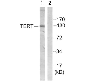 Western Blot - Anti-Telomerase Antibody (B1183) - Antibodies.com