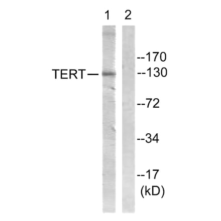 Western Blot - Anti-Telomerase Antibody (B1183) - Antibodies.com