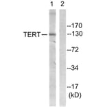 Western Blot - Anti-Telomerase Antibody (B1183) - Antibodies.com