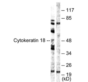 Western Blot - Anti-Keratin 18 Antibody (B0882) - Antibodies.com