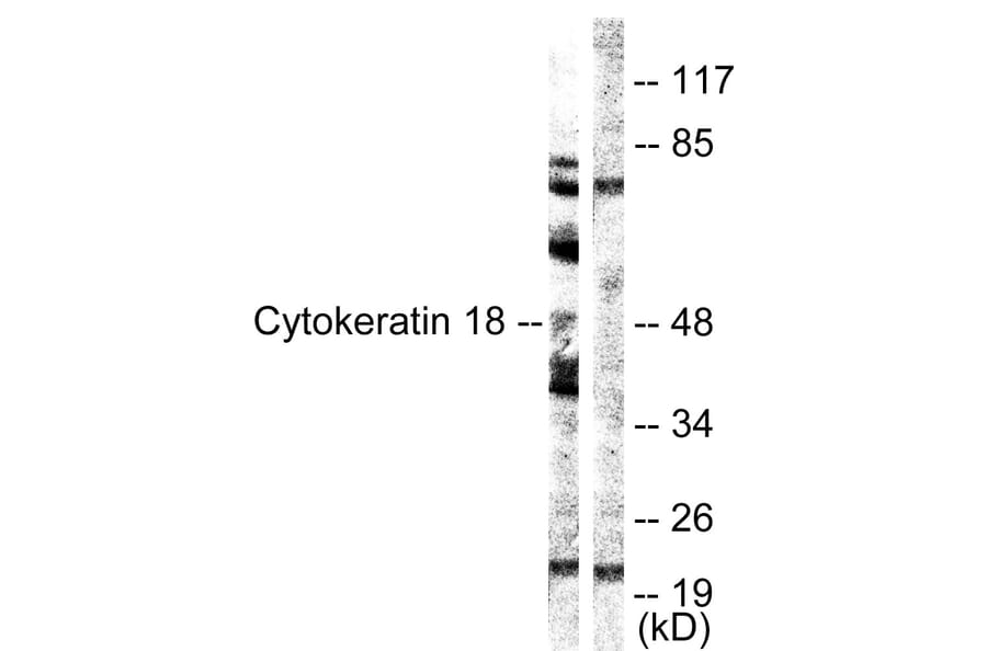 Western Blot - Anti-Keratin 18 Antibody (B0882) - Antibodies.com
