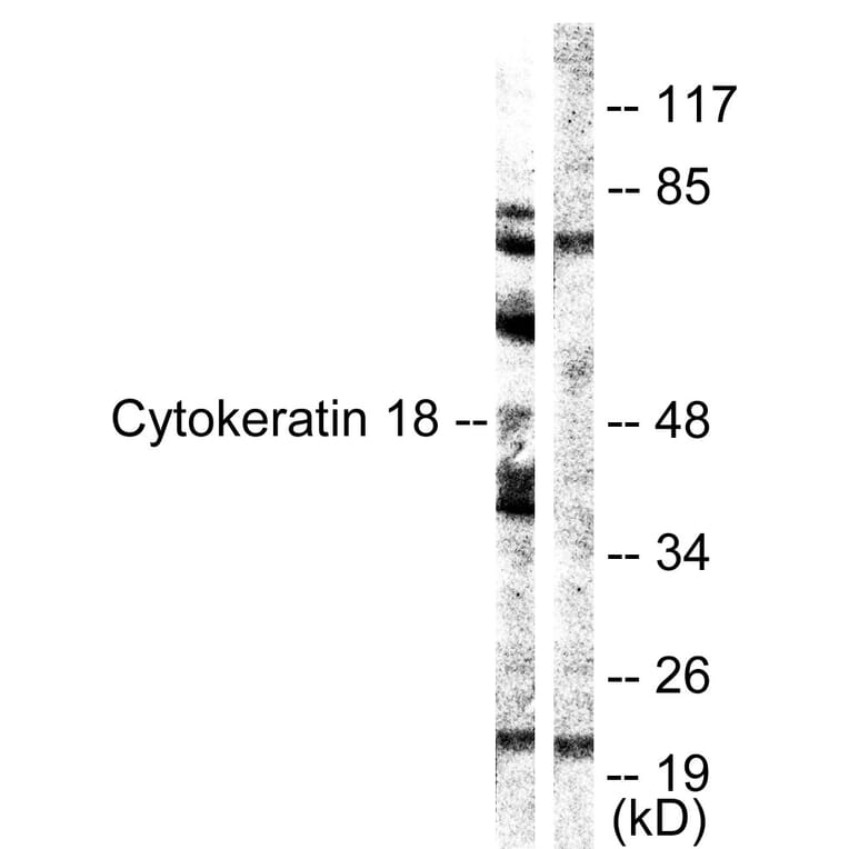 Western Blot - Anti-Keratin 18 Antibody (B0882) - Antibodies.com