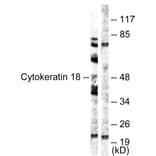 Western Blot - Anti-Keratin 18 Antibody (B0882) - Antibodies.com