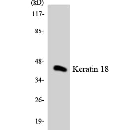 Western Blot - Anti-Keratin 18 Antibody (R12-2950) - Antibodies.com