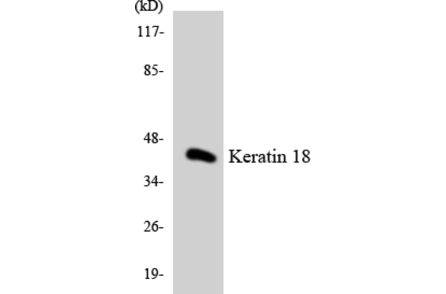 Western Blot - Anti-Keratin 18 Antibody (R12-2950) - Antibodies.com