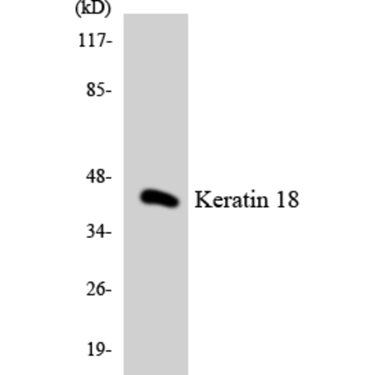 Western Blot - Anti-Keratin 18 Antibody (R12-2950) - Antibodies.com