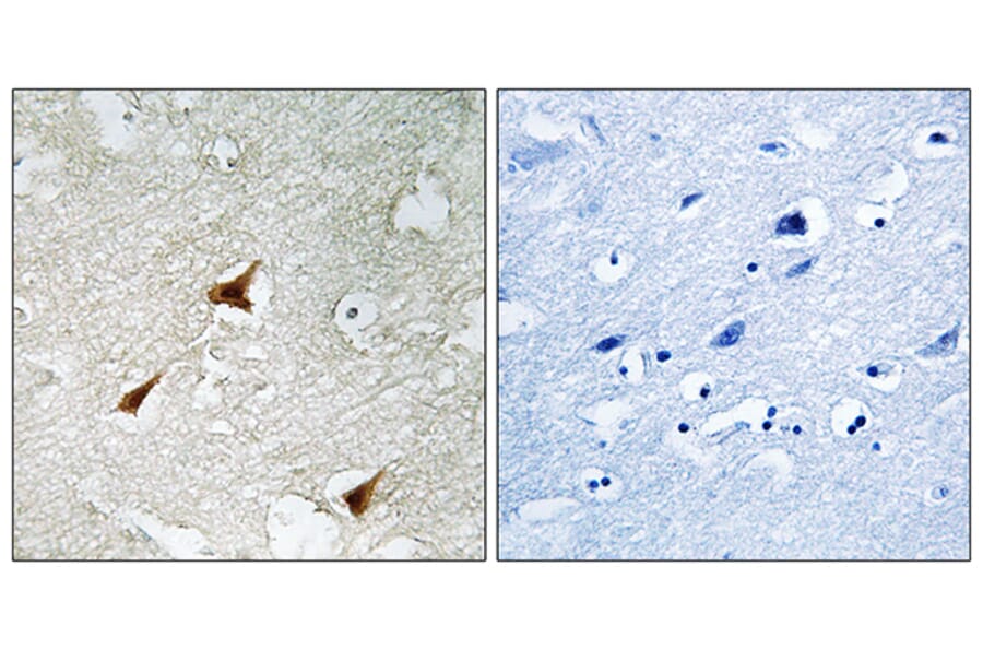 Immunohistochemistry - Anti-p19 INK4d Antibody (C10741) - Antibodies.com