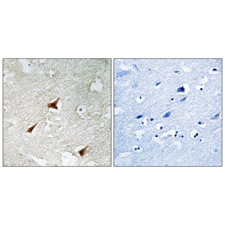 Immunohistochemistry - Anti-p19 INK4d Antibody (C10741) - Antibodies.com