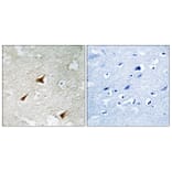 Immunohistochemistry - Anti-p19 INK4d Antibody (C10741) - Antibodies.com