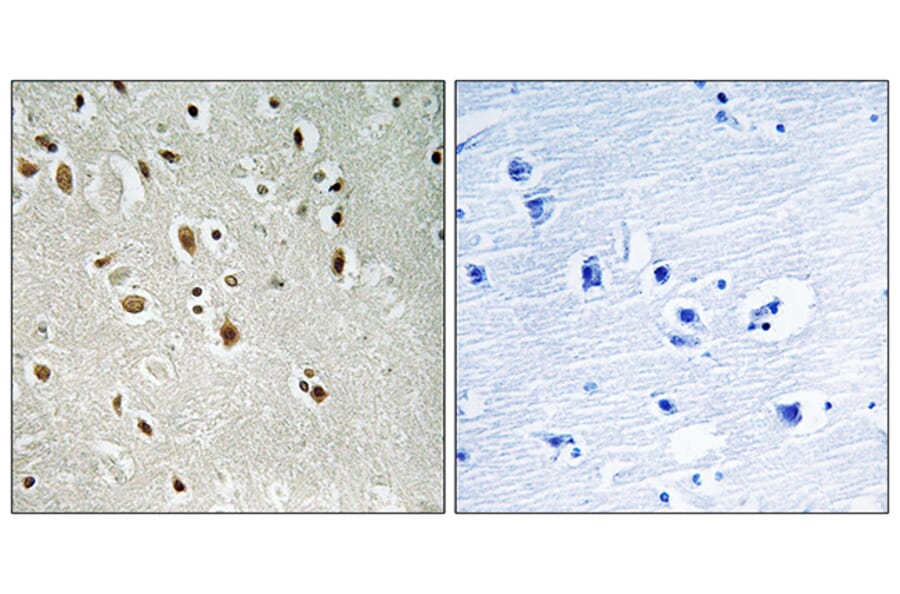 Immunohistochemistry - Anti-ANKRD20A3 Antibody (C14494) - Antibodies.com