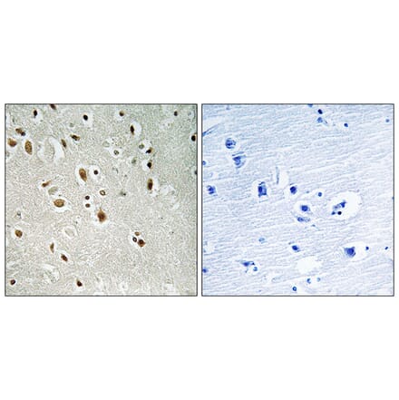 Immunohistochemistry - Anti-ANKRD20A3 Antibody (C14494) - Antibodies.com