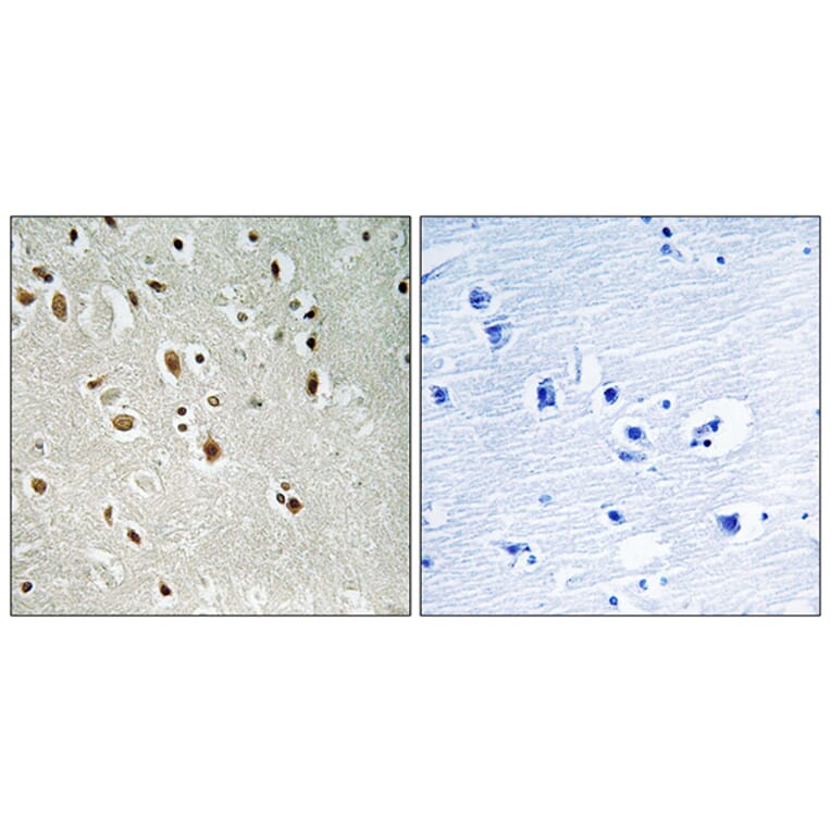 Immunohistochemistry - Anti-ANKRD20A3 Antibody (C14494) - Antibodies.com