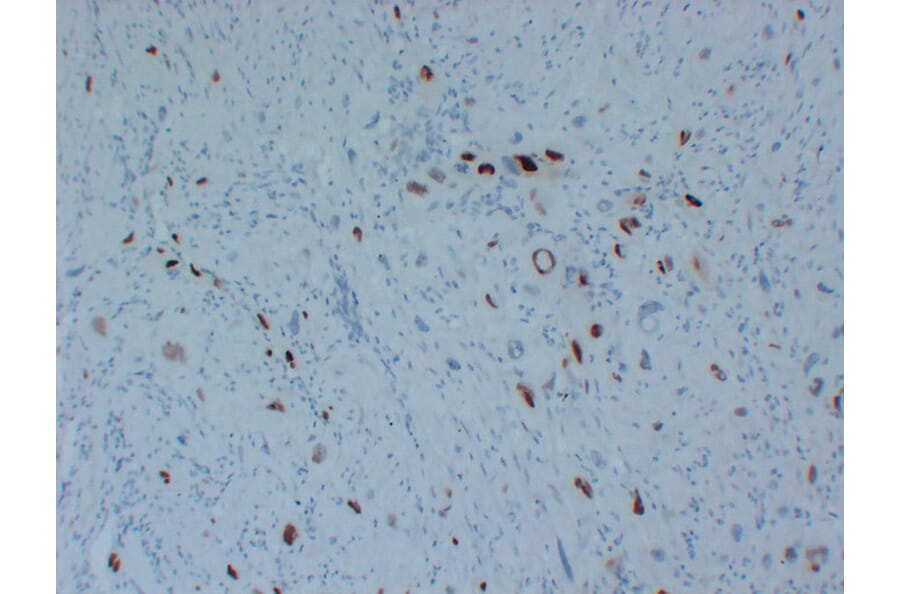 Immunohistochemistry - Anti-p57kip2 Antibody (V0106) - Antibodies.com
