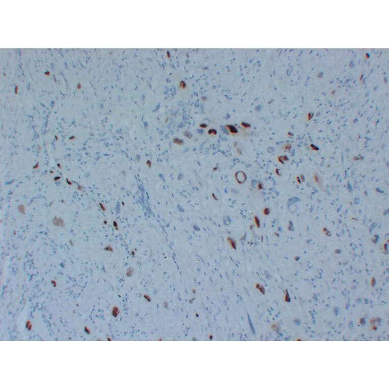 Immunohistochemistry - Anti-p57kip2 Antibody (V0106) - Antibodies.com