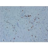 Immunohistochemistry - Anti-p57kip2 Antibody (V0106) - Antibodies.com