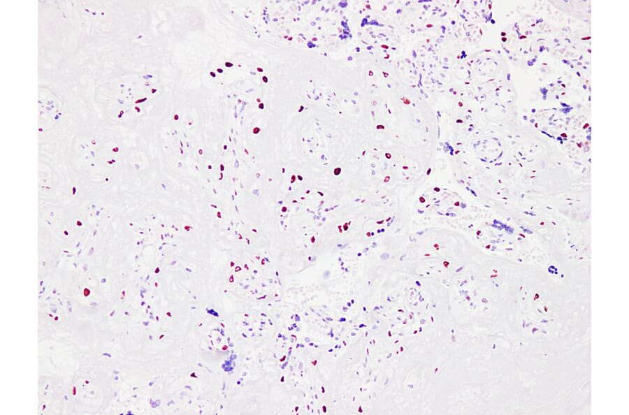 Immunohistochemistry - Anti-p57kip2 Antibody (V0106) - Antibodies.com