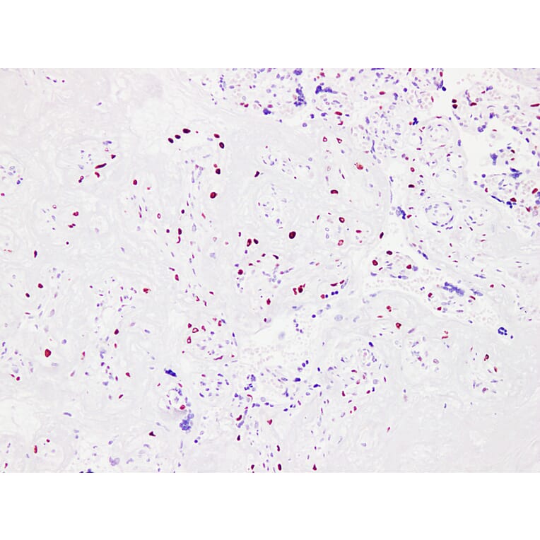 Immunohistochemistry - Anti-p57kip2 Antibody (V0106) - Antibodies.com