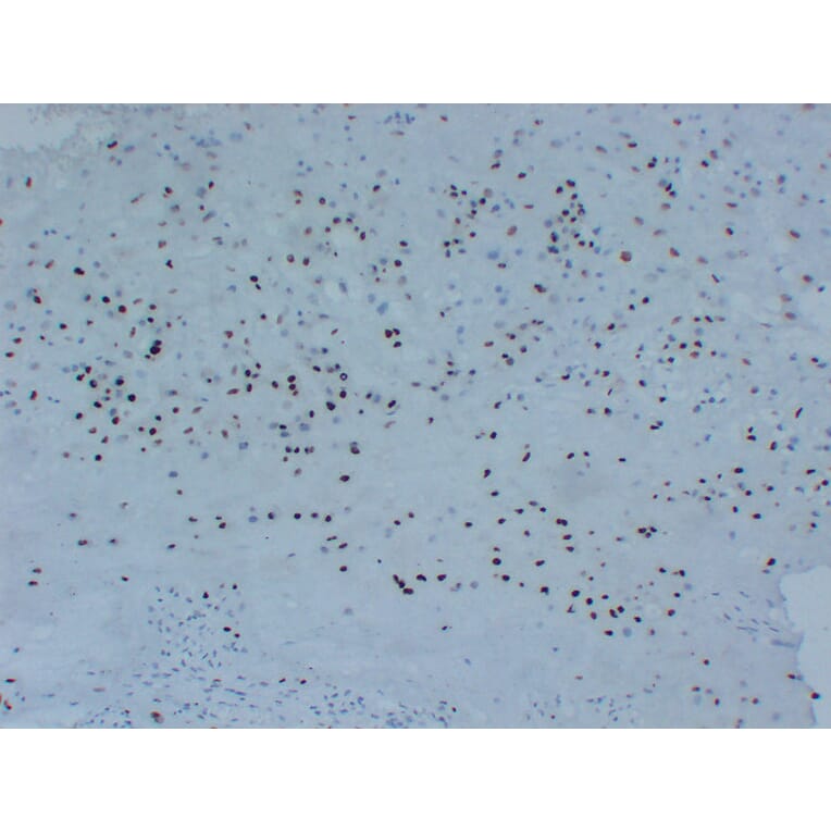 Immunohistochemistry - Anti-p57kip2 Antibody (V0106) - Antibodies.com