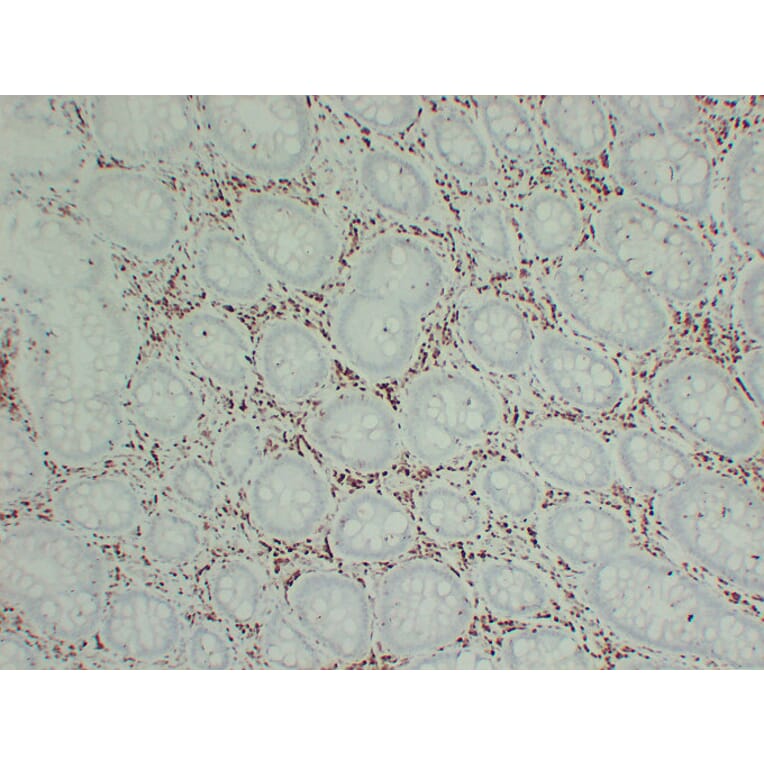 Immunohistochemistry - Anti-p27Kip1 Antibody (V0143) - Antibodies.com